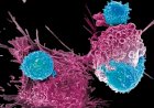 Metode Baru Ini Diklaim Mampu Hancurkan Sel Kanker hingga 99 Persen